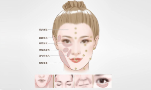 填充部位示意图.jpg