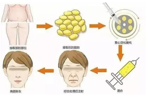 面部填充步骤图.png