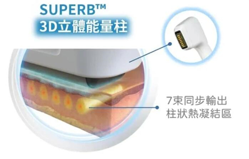 去韓國打美版音波邊間抵？新沙Bailor皮膚科2週年買大送小，索夫波免費送埋給你