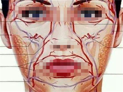 玻尿酸栓塞静脉动脉展示图.png 玻尿酸栓塞静脉动脉展示图.png