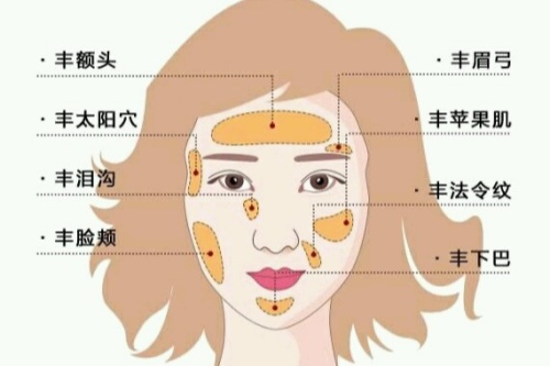 自体脂肪面部填充卡通图.jpg 自体脂肪面部填充卡通图.jpg