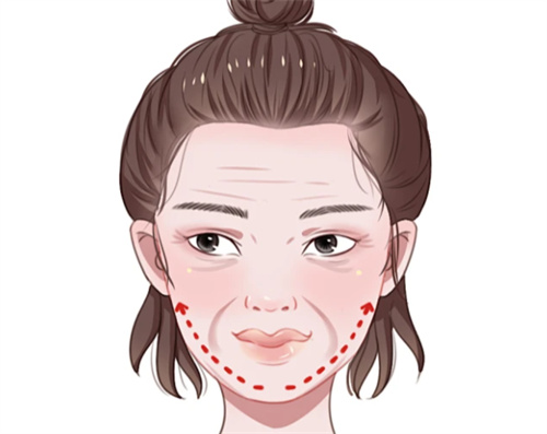 面部抗衰提升卡通图.jpg