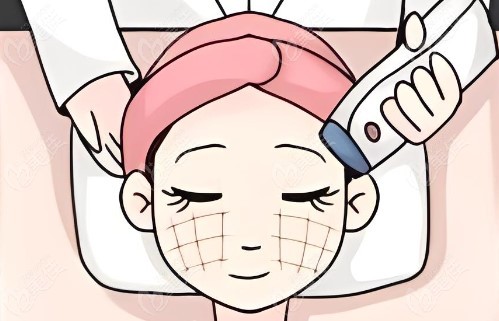 热玛吉操作过程.jpg 热玛吉操作过程.jpg
