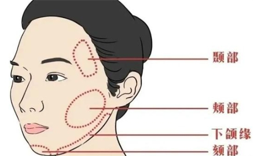 面部提升可以提升的区域.jpg 面部提升可以提升的区域.jpg