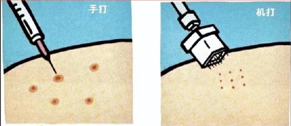 水光针注射.jpg 水光针注射.jpg
